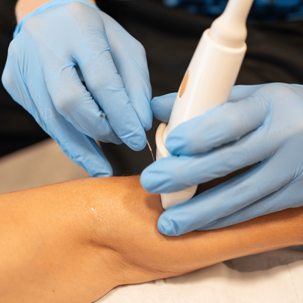Un chico realizando una sesión de EPI en un centro de fisioterapia en Santa Eugènia de Berga