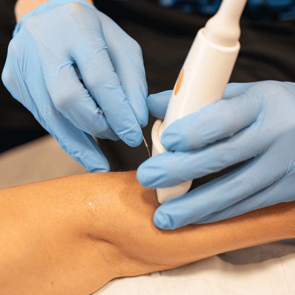 Un chico realizando una sesión de EPI ecoguiada en un centro de fisioterapia en Santa Eugènia de Berga
